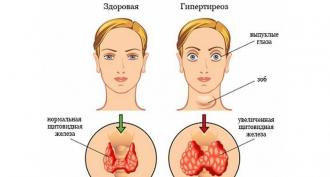 How to treat thyroid at home